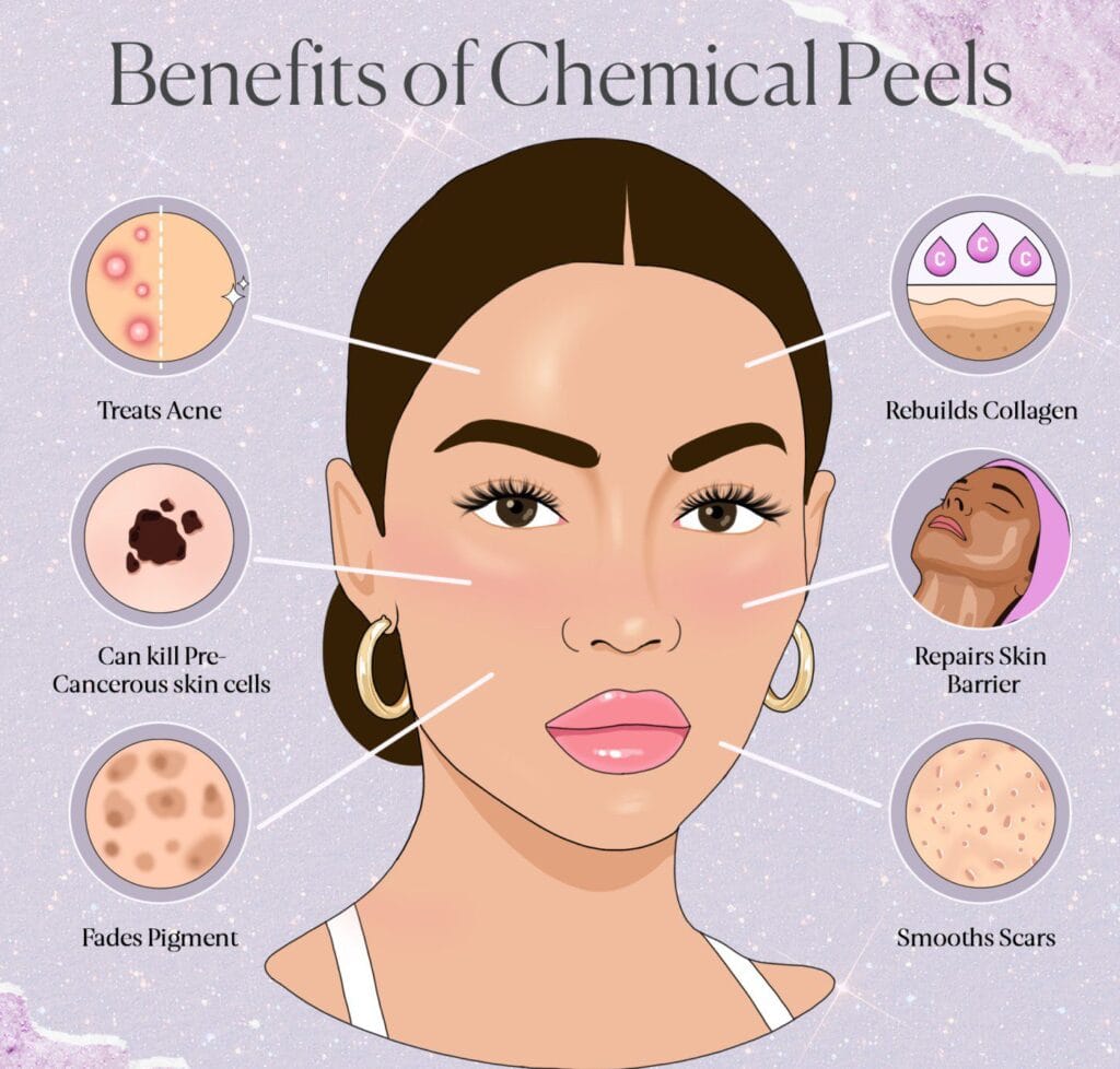 Best Chemical Peel in Trivandrum