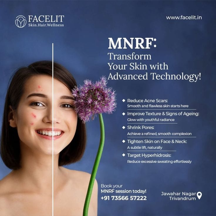 Cost of MNRF