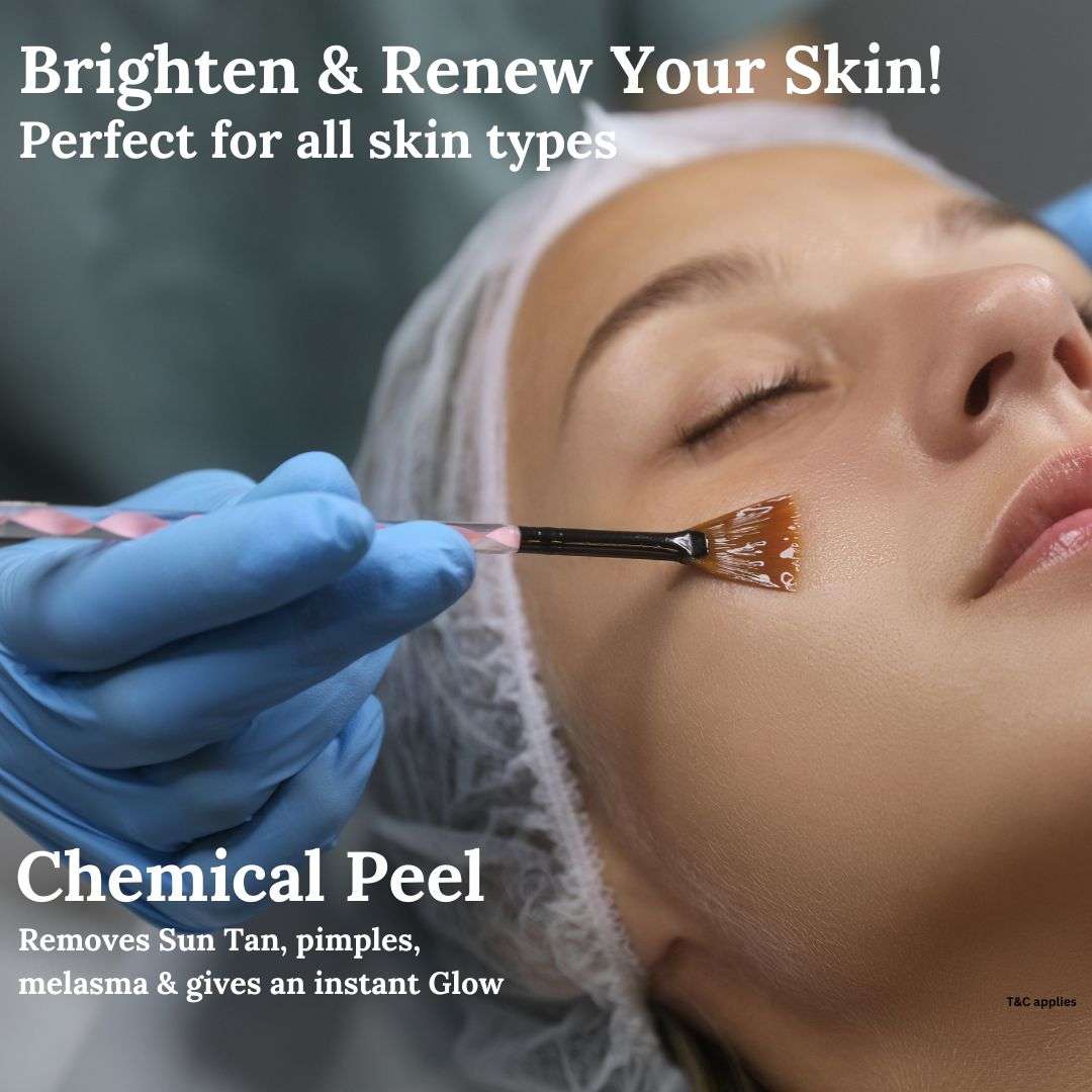 best peels inn Jayanagar