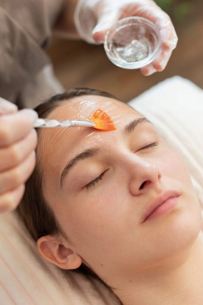 Cost of Peels in Jayanagar