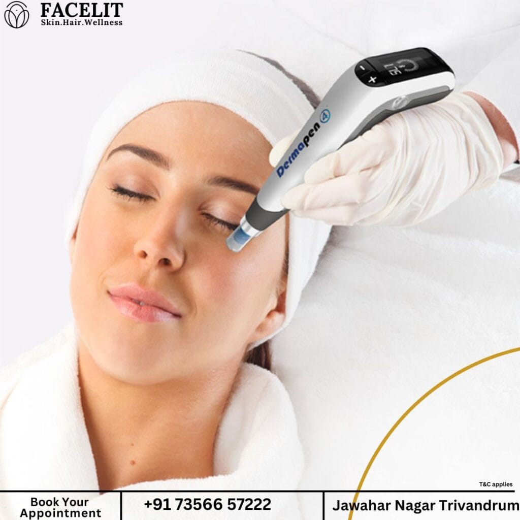 Best Micro Needling clinic in Trivandrum