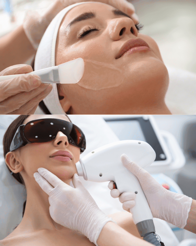 Skin Tag and Tan Removal in Bangalore