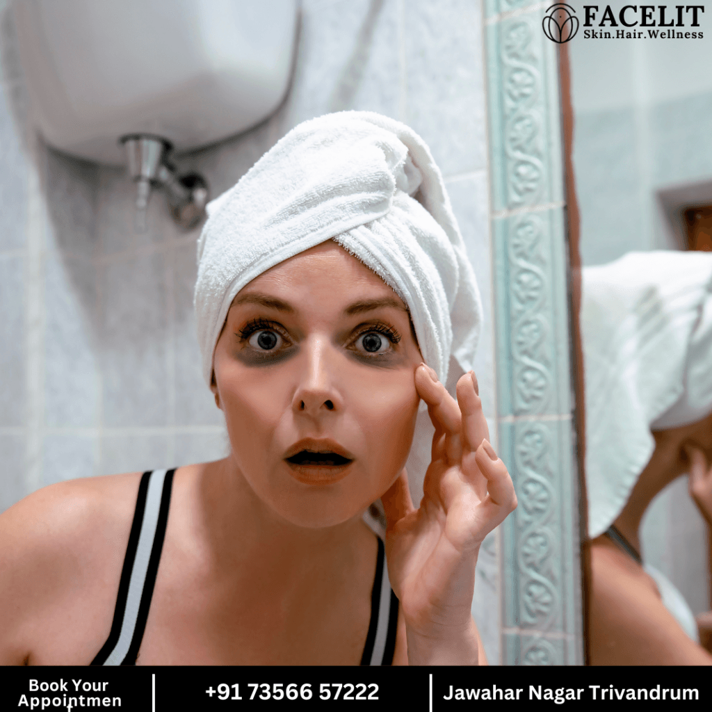 under eye circle treatment done at facelit clinic
