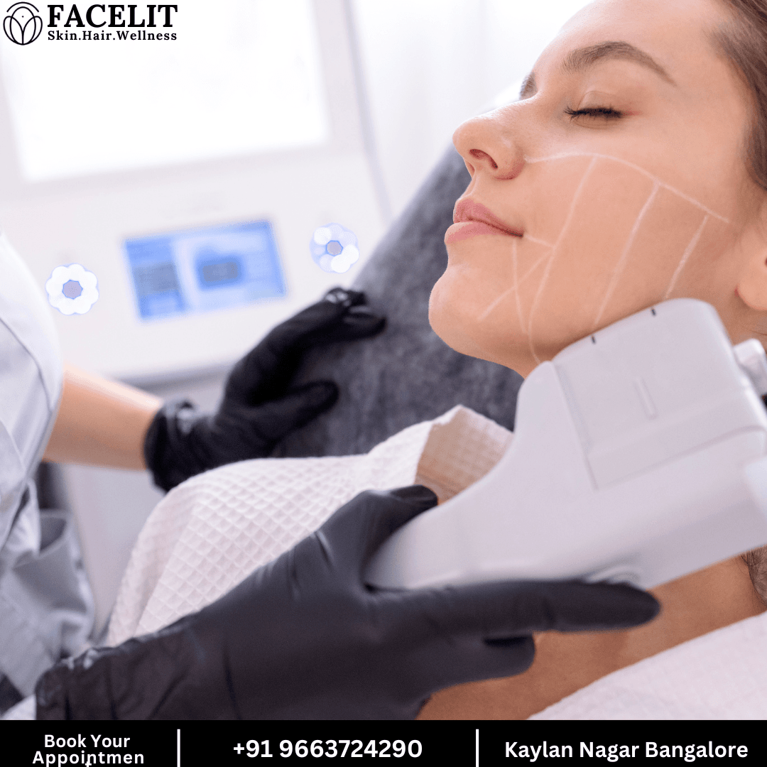Jawline Lift Treatment in Bangalore