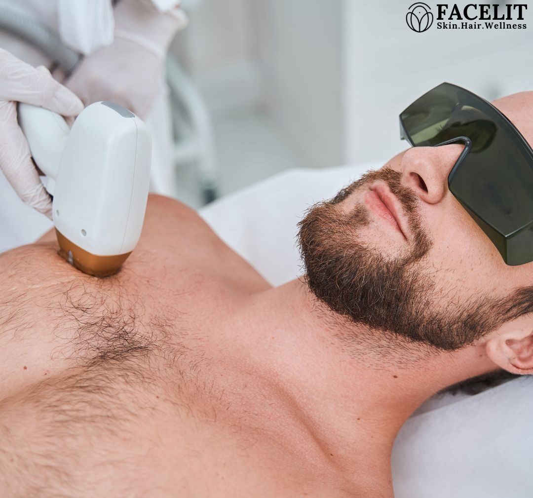 Best Laser Hair Reduction in Jayanagar
