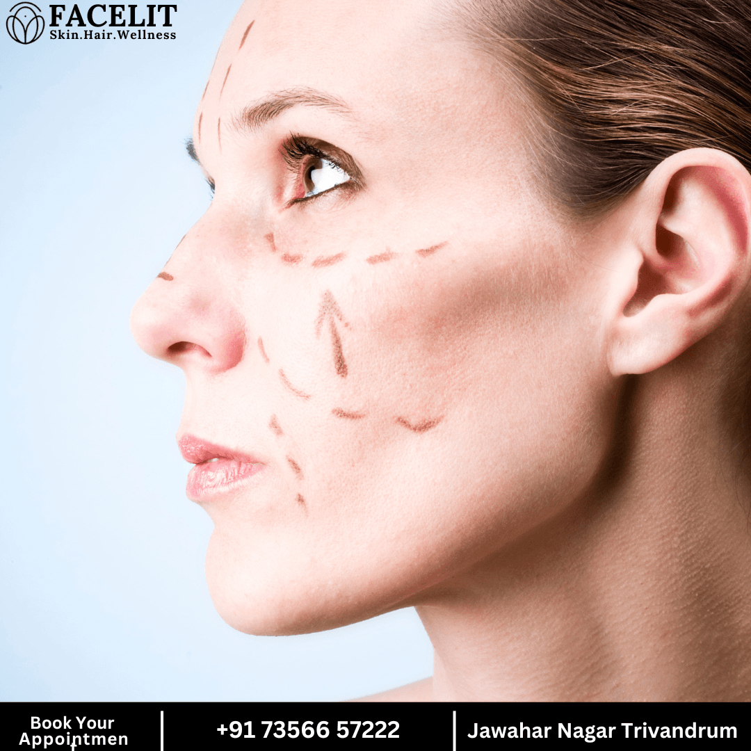 Best Profhilo Treatment in Trivandrum