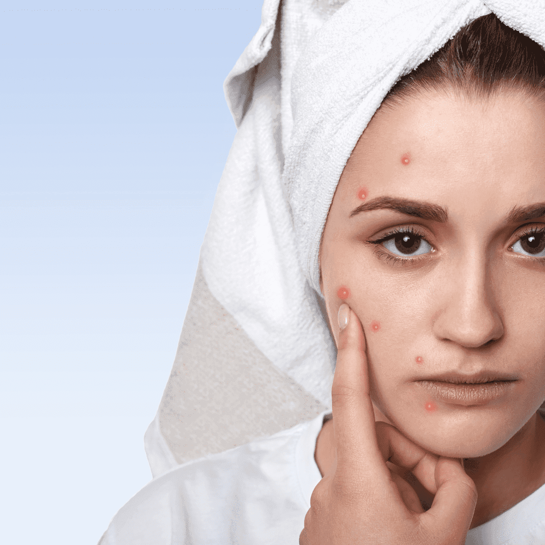 Top 10 Skin Problems