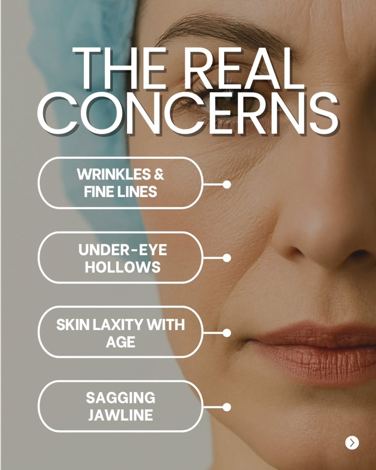 Advanced Anti-Aging Treatment for Wrinkles