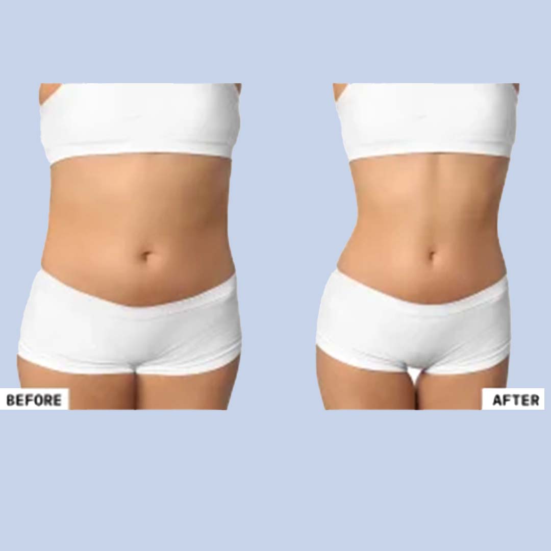 Best Weight Loss Treatment before and after