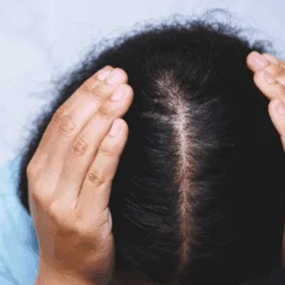 hair loss treatment